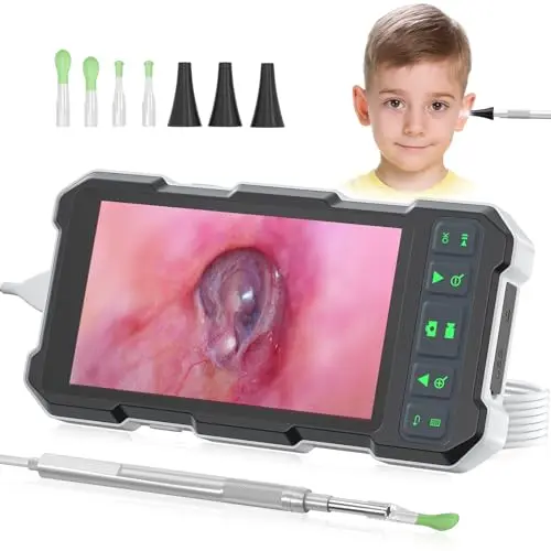 QzkBoeo video otoscope with 4.5-inch screen and ear wax removal kit